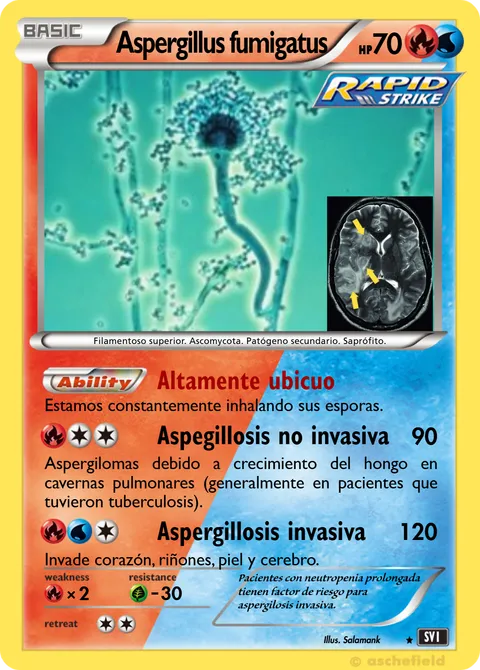 Aspergillus fumigatus