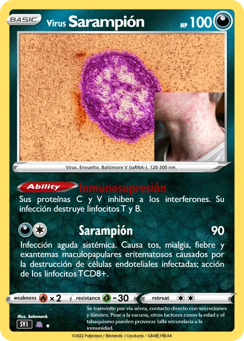 Sarampión